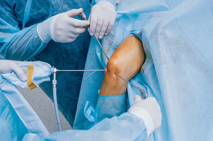 Arthroscopy Surgery  