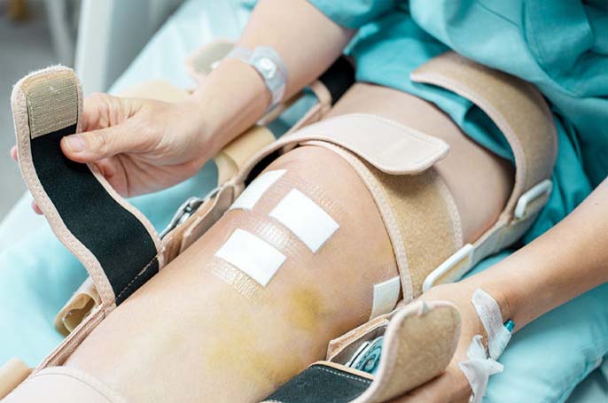 Arthroscopy Surgery  