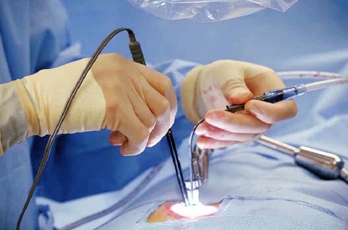 Endoscopic Spine Surgery