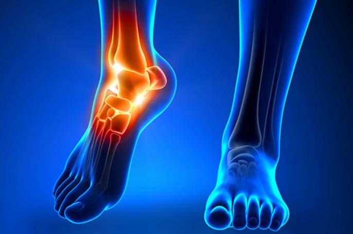 Foot and Ankle Surgery