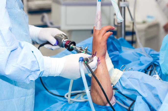 Hand and Wrist Surgery