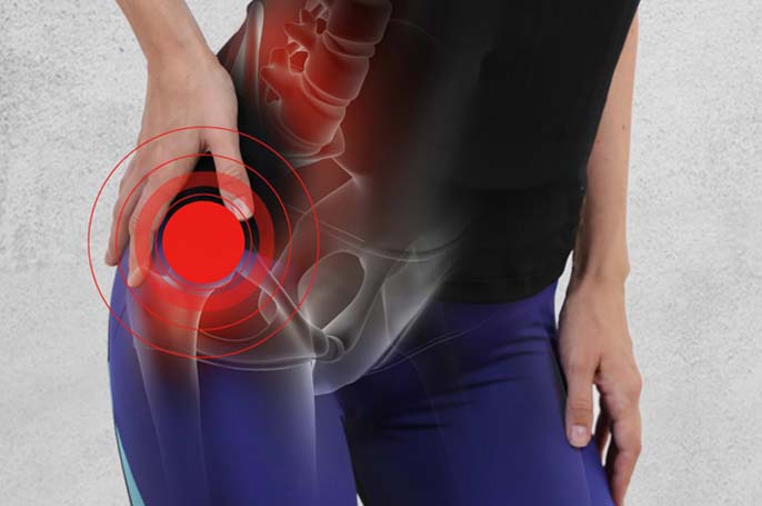 Hip Replacement 