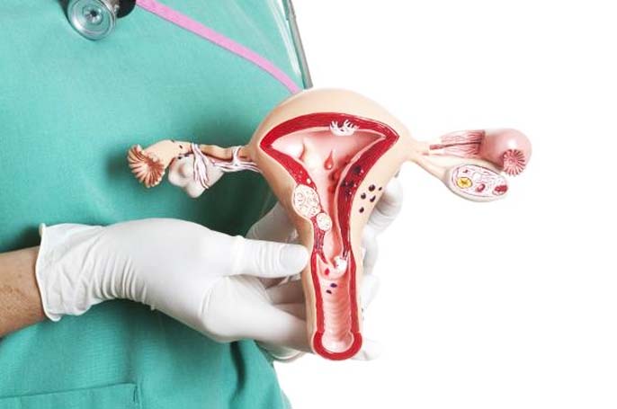 Hysterectomy