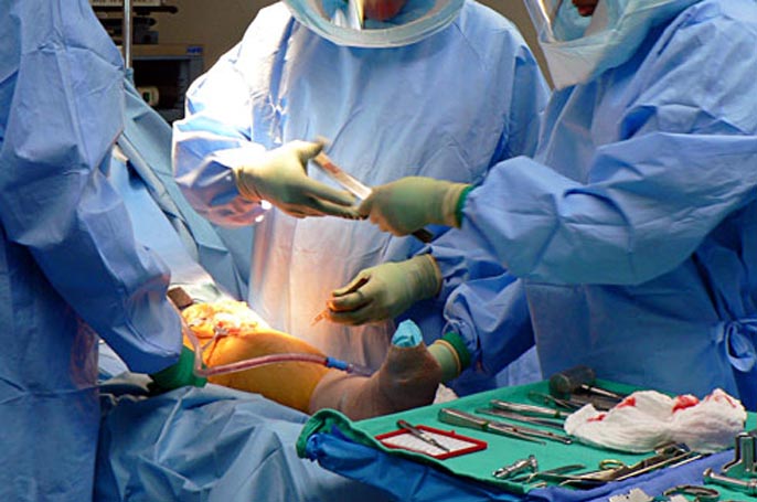 Knee Replacement  