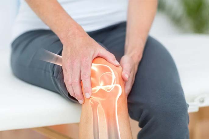 Knee Replacement 