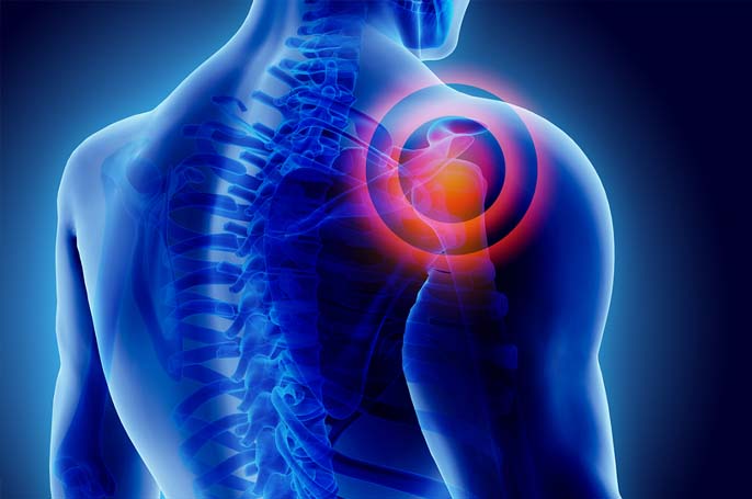 Rotator Cuff Surgery